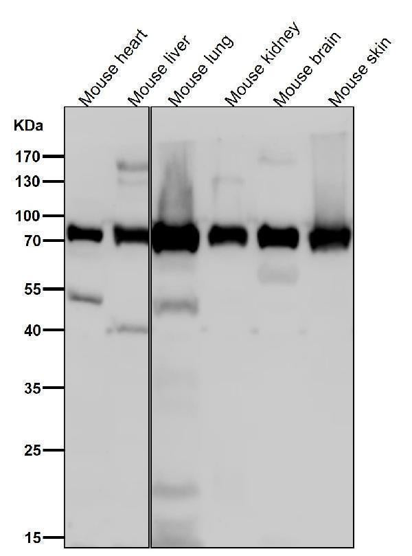 All lanes use the Antibody at 1:1W dilution for 1 hour at room temperature.