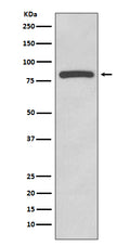 Western blot analysis of Glycogen synthase expression in HeLa cell lysate.