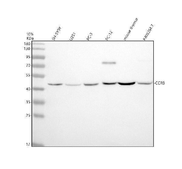 Anti-CCR8 Rabbit Monoclonal Antibody