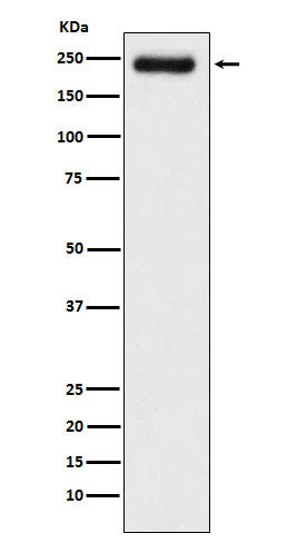 Western blot analysis of Laminin gamma 1 expression in A431 cell lysate.