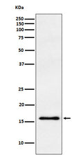 Western blot analysis of gamma Synuclein expression in human fetal brain lysate.
