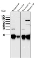 All lanes use the Antibody at 1:5K dilution for 1 hour at room temperature.