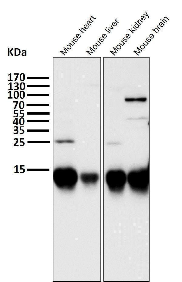 All lanes use the Antibody at 1:5K dilution for 1 hour at room temperature.