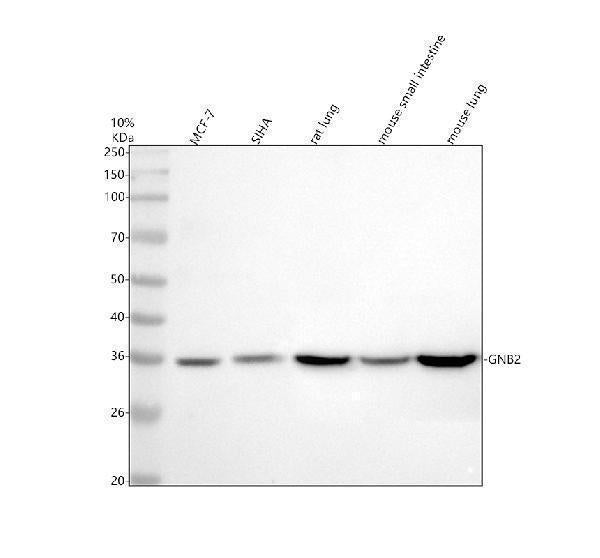 Anti-GNB2 Rabbit Monoclonal Antibody