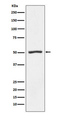 Western blot analysis of Proteasome 19S S5A expression in K562 cell lysate.