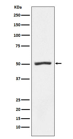 Western blot analysis of Proteasome 19S S5A expression in K562 cell lysate.