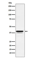 Anti-FOXF1 Rabbit Monoclonal Antibody