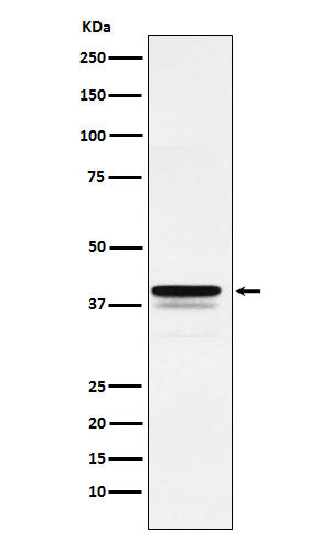 Anti-FOXF1 Rabbit Monoclonal Antibody
