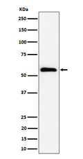 Western blot analysis of PNK / PNKP expression in HeLa cell lysate.