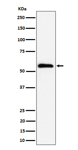 Western blot analysis of PNK / PNKP expression in HeLa cell lysate.