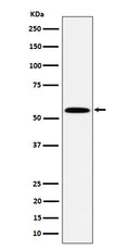 Western blot analysis of PNK / PNKP expression in Jurkat cell lysate.