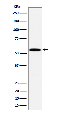 Western blot analysis of PNK / PNKP expression in Jurkat cell lysate.