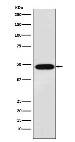 Western blot analysis of MAGE 1 expression in A375 cell lysate.