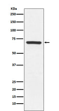 Western blot analysis of MEKK3 expression in Hela cell lysate.