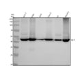 Anti-KAT1 / HAT1 Rabbit Monoclonal Antibody