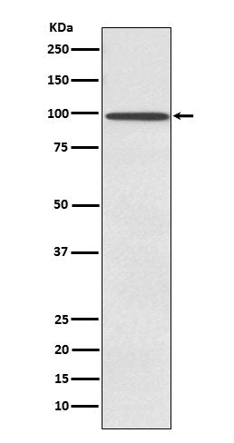 Western blot analysis of SUN1 expression in Ramos cell lysate.