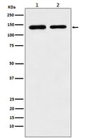 Western blot analysis of SA2 expression in (1) K562 cell lysate; (2) Raw264.7 cell lysate.