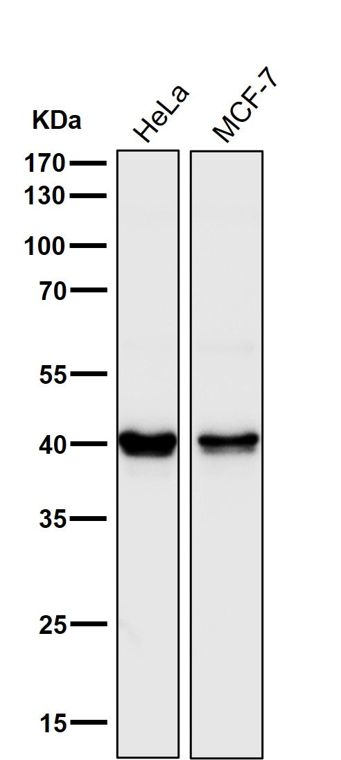 All lanes use the Antibody at 1:3K dilution for 1 hour at room temperature.