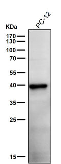 All lanes use the Antibody at 1:1K dilution for 1 hour at room temperature.