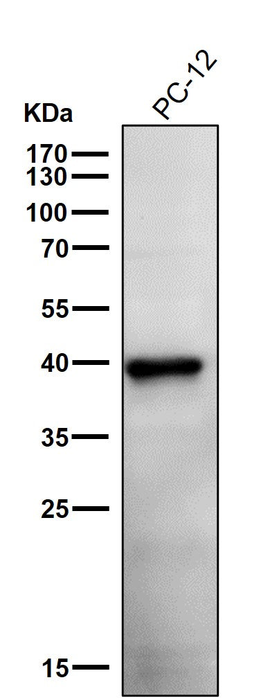 All lanes use the Antibody at 1:1K dilution for 1 hour at room temperature.