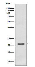 Western blot analysis of MTCO2 expression in K562 cell lysate.