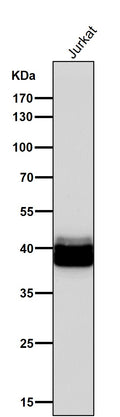 All lanes use the Antibody at 1:1K dilution for 1 hour at room temperature.