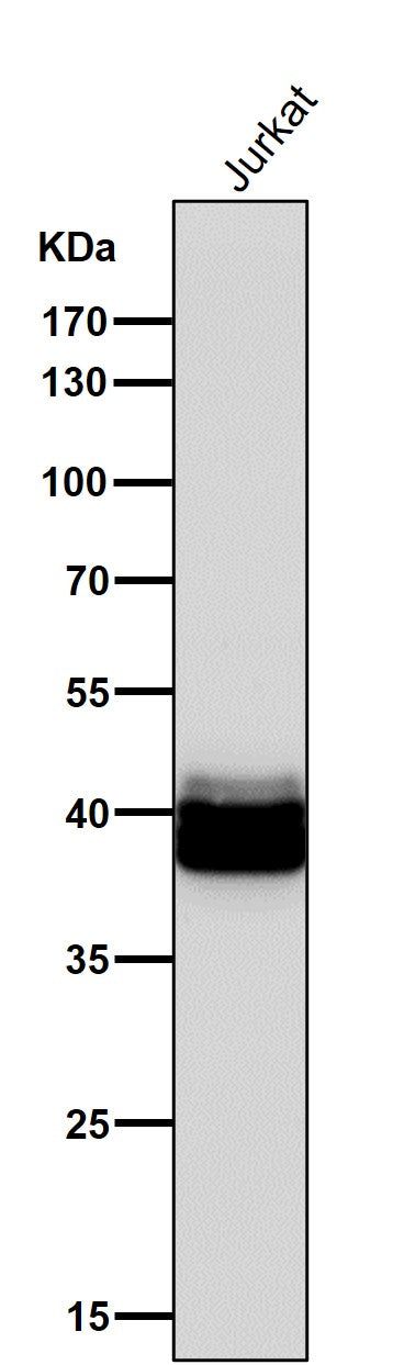 All lanes use the Antibody at 1:1K dilution for 1 hour at room temperature.