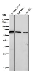 All lanes use the Antibody at 1:1W dilution for 1 hour at room temperature.