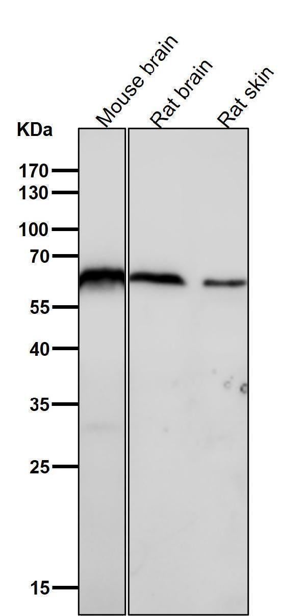 All lanes use the Antibody at 1:1W dilution for 1 hour at room temperature.