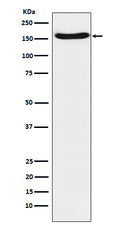 Western blot analysis of FANCA expression in A431 cell lysate.