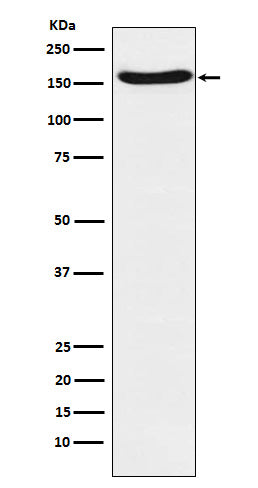 Western blot analysis of FANCA expression in A431 cell lysate.