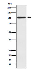 Western blot analysis of Alpha actinin 2 expression in human skeletal muscle lysate.