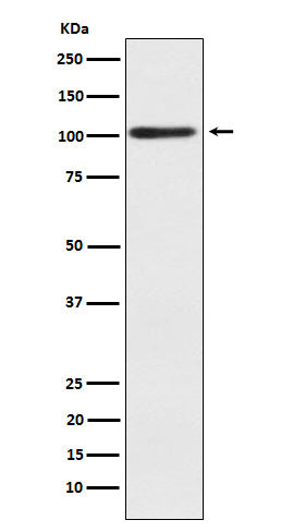 Western blot analysis of Alpha actinin 2 expression in human skeletal muscle lysate.