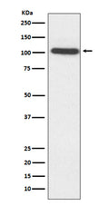 Anti-ACTN2 Rabbit Monoclonal Antibody