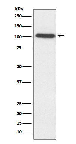 Anti-ACTN2 Rabbit Monoclonal Antibody