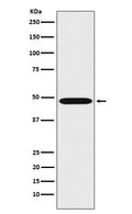 Western blot analysis of Renin expression in K562 cell lysate.