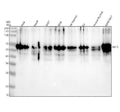 Anti-Cytokeratin 9 KRT9 Rabbit Monoclonal Antibody