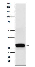 Western blot analysis of beta Casein expression in Human milk lysate.