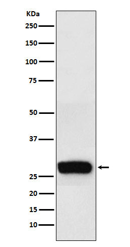 Western blot analysis of beta Casein expression in Human milk lysate.