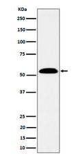 Western blot analysis of ALDH7A1 expression in SW480 cell lysate.