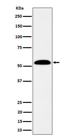 Western blot analysis of ALDH7A1 expression in SW480 cell lysate.