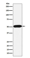 Western blot analysis of FKBP38 expression in Jurkat cell lysate.