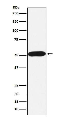 Western blot analysis of FKBP38 expression in Jurkat cell lysate.
