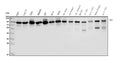Anti-DDX1 Picoband® Antibody (monoclonal, 11E5)