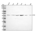 Anti-S1PR3 Rabbit Monoclonal Antibody