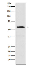 Western blot analysis of alpha Internexin expression in SHSY5Y cell lysate.