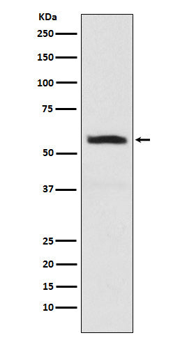 Western blot analysis of alpha Internexin expression in SHSY5Y cell lysate.