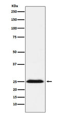 Western blot analysis of BAP31 expression in NCCIT cell lysate.