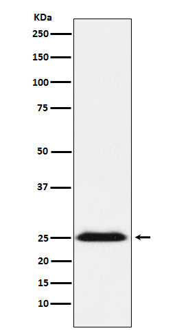 Western blot analysis of BAP31 expression in NCCIT cell lysate.