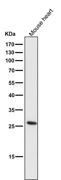 All lanes use the Antibody at 1:5K dilution for 1 hour at room temperature.